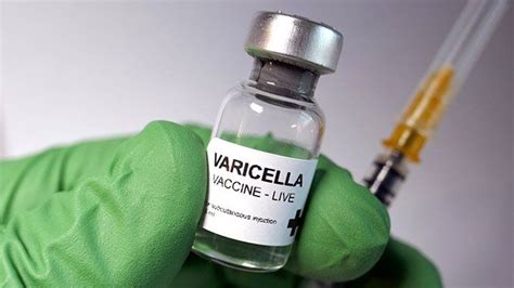 varicella zoster vaccine icd 10